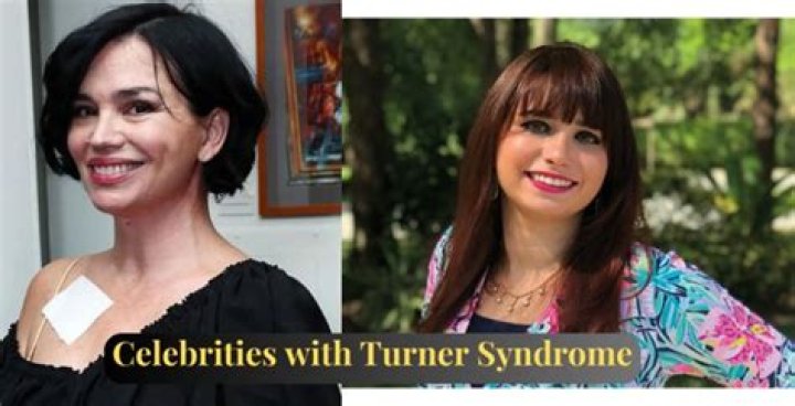 Breaking Barriers: Celebrating Celebrities With Turner Syndrome