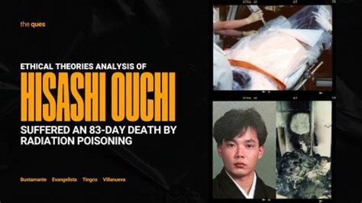 Hisashi Ouchi's Journey: The Unseen Struggles After Radiation Exposure