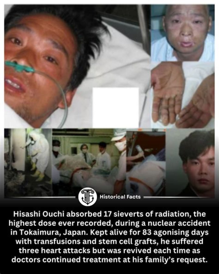 Hisashi Ouchi: A Journey Through Radiation And Resilience
